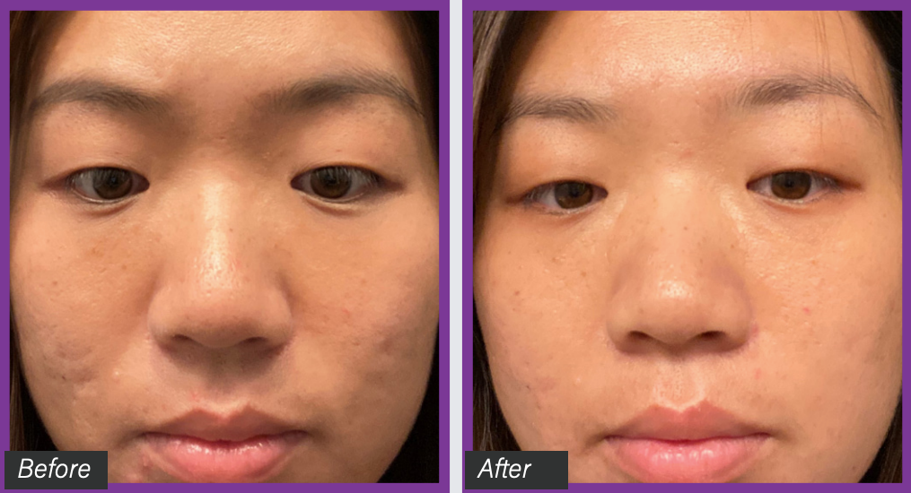 Laser Skin Treatments My Face Surgeon laser-skin-treatments-my-face-surgeon
